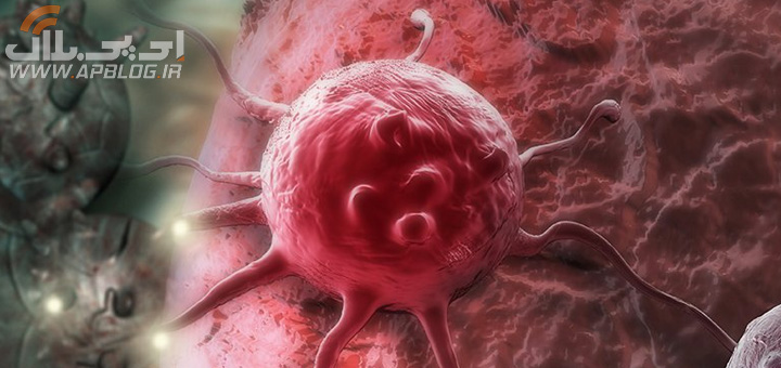 You are currently viewing محققان روشی جدید برای نابودی سلول‌های سرطانی کشف کردند